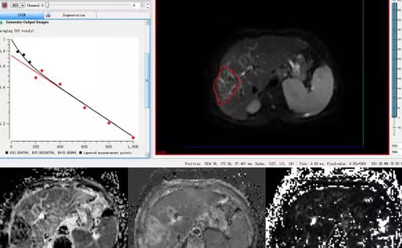 全景张建博士磁共振课题喜获委级科研面上项目立项