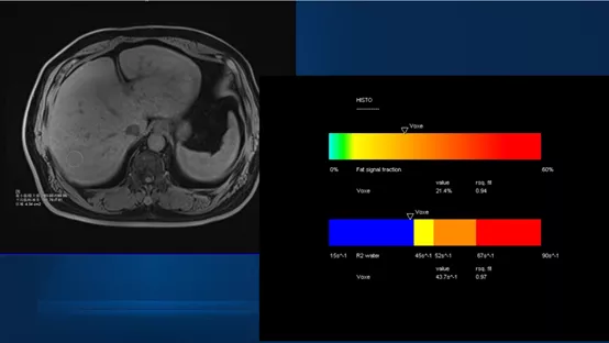 微信图片_20200324093440