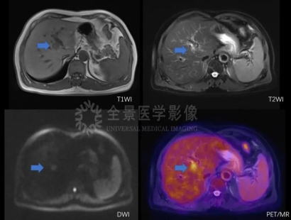 petmr检查影像图