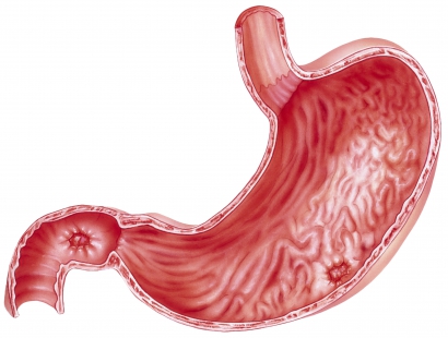核磁共振检查消化道疾病