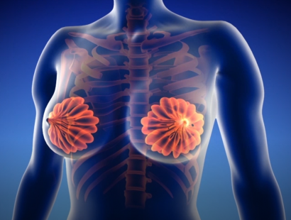 女性防癌筛查有哪些