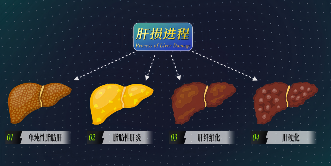 42岁肝脏弹性MRE案例｜止步于查出“脂肪肝”=放任肝脏持续受损